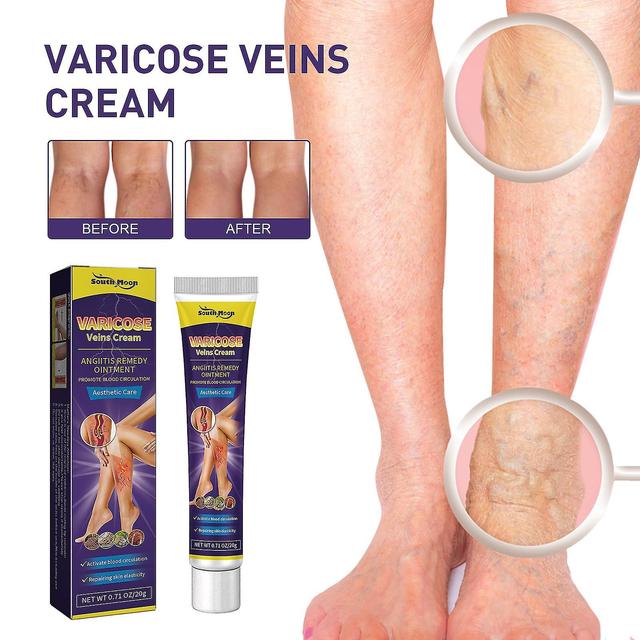 South Moon Vein Relief Cream Repairs Varicose Veins In The Legs And Relieves Swelling And Pain Of Leg Veins Massage Oil1pcs) -GSL 1PCS on Productcaster.