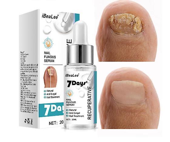 Onychomycosis special antibacterial liquid remover cream thickening soft nail onychomycosis special water 20ml on Productcaster.