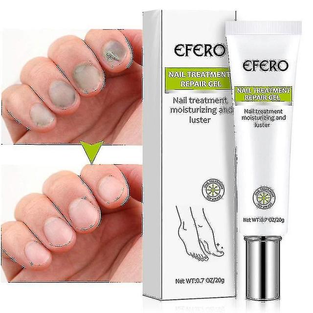 Toenail Fungus Treatment Gel - Restore Brittle, Yellow Nails - Nail Repair for Damaged Nails on Productcaster.