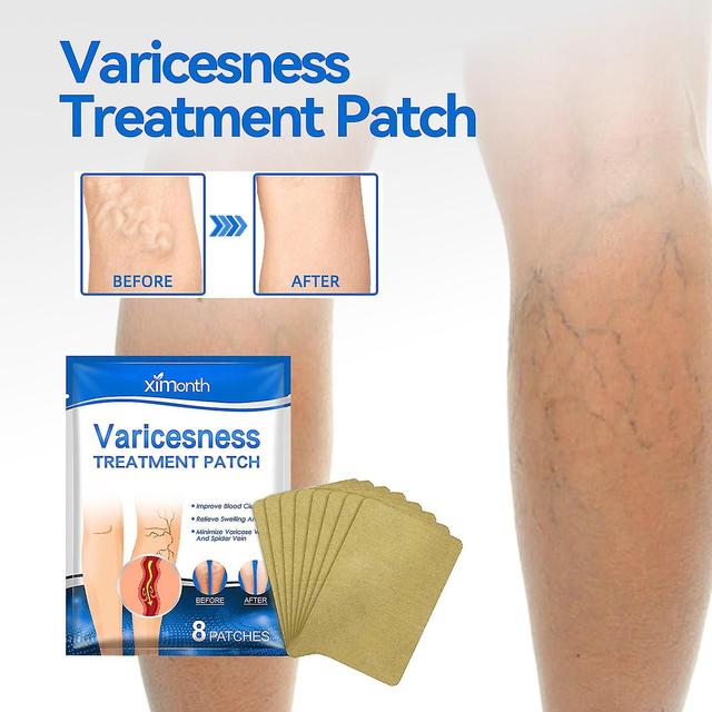 Ximonth Vein Care Patch Smoothes Blood Vessel Bulges And Massages To Relieve Leg Varicose Veins And Leg Swelling Massage Oil1pcs) -GSL 1PCS on Productcaster.