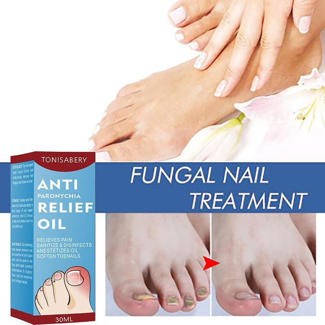 unbrand Paronychia Relief Oil, Anti Paronychia Relief Oil, Toe and Fingernail Repair for Damaged Discolored Thick Nails 2 Pcs on Productcaster.