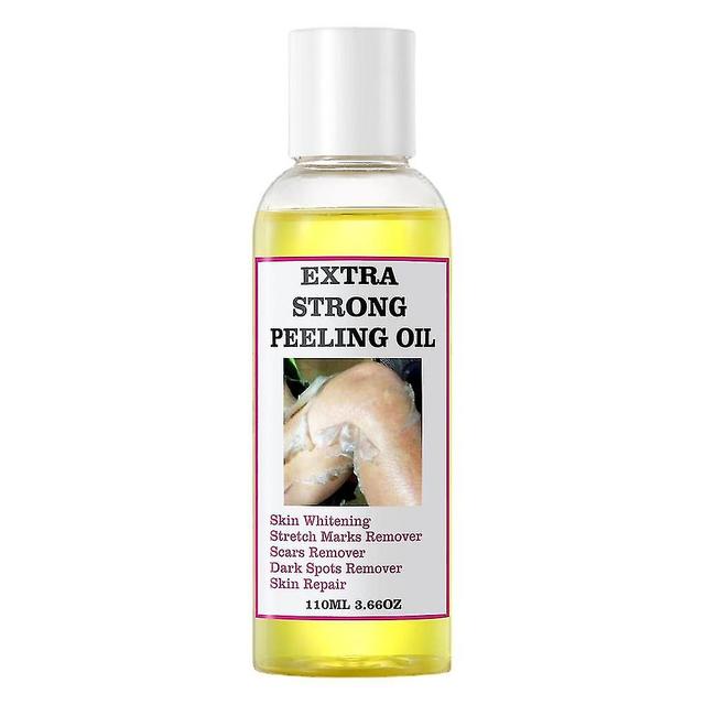 Guoguo Extra Strength Yellow Peeling Oil - 110ml on Productcaster.