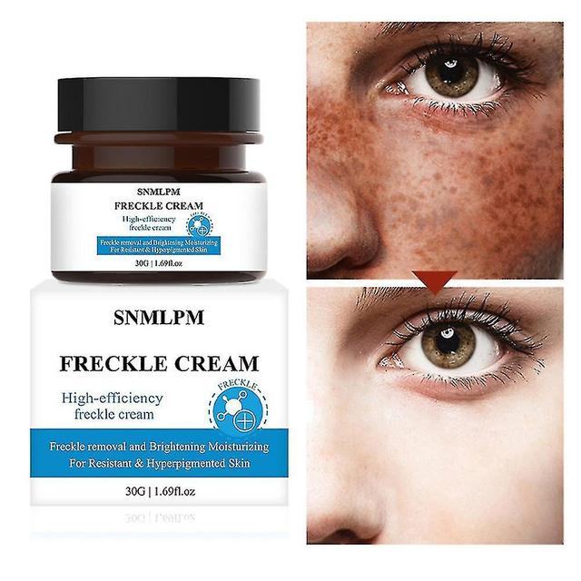 Sterke verwijdering Melasma Whitening Cream Lighten Spots Verwijder Sproeten Spikkel Melanine Pigment Crèmes on Productcaster.