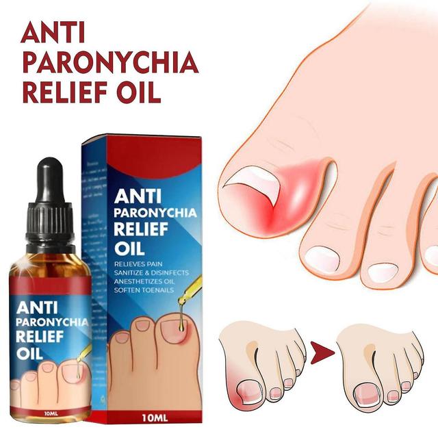 1pc Anti Paronychia Relief Oil, Ingrown Toenail Treatment, Nail Renewal Liquid For Damaged & Discolo 10packs on Productcaster.