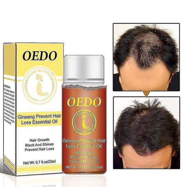 Oedo Ginseng Hair Growth Essential Oil Prevents Hair on Productcaster.