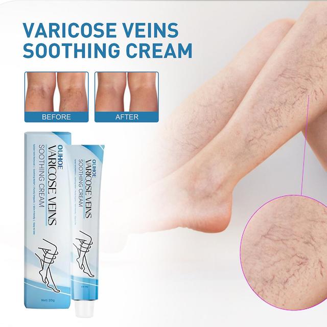 3Pcs Vein Care Fading Cream Varicose Veins Cream for Legs Veins Herbal Ointment on Productcaster.