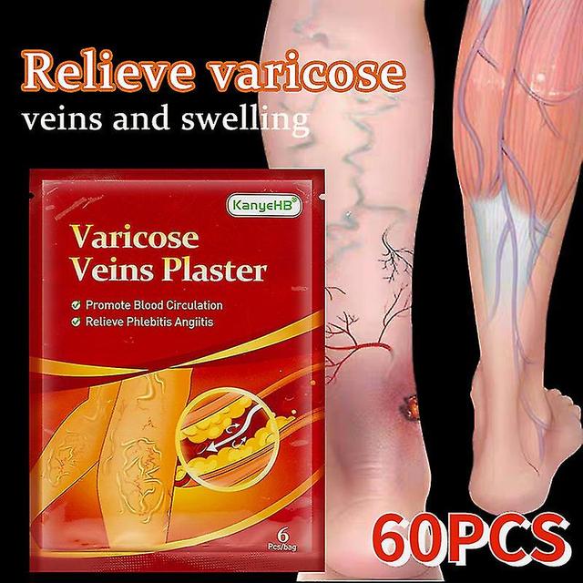 Mja 60pcs Varicose Veins Ointmnet Vasculitis Phlebitis Spider Cream Varicosity Angiitis Removal Herbal Medical Plaster Health Care 30pcs in 5 bags on Productcaster.