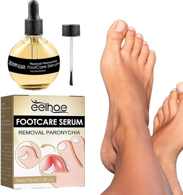 Paronychia Oil Removal, Anti-paronychia Treatment Improves Foot Nail Health on Productcaster.