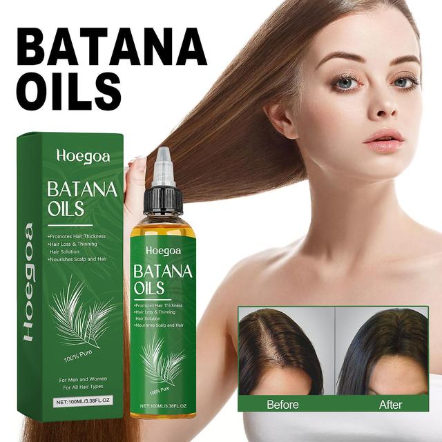 Frusde Olio di Batana per la crescita dei capelli, Olio di Batana grezzo biologico dall'Honduras, Olio di Batana grezzo puro e naturale al 100% per... on Productcaster.