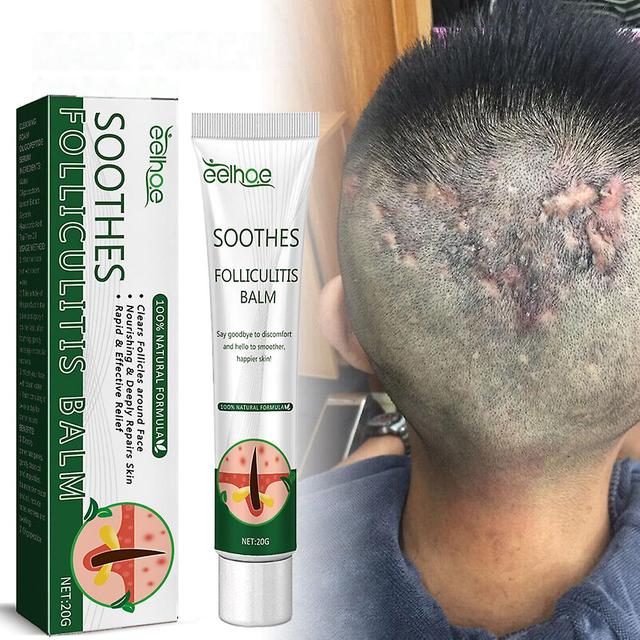 Hair Follicle Cream Folliculitis Skin Care Inflammation on Productcaster.