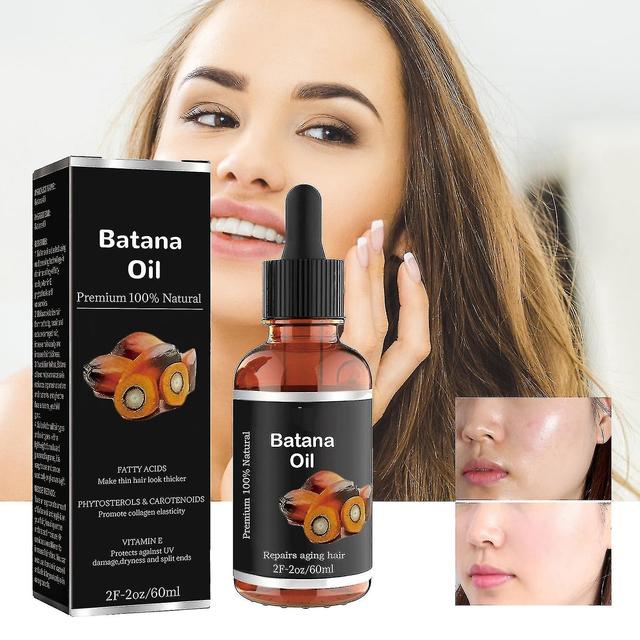 Batana Oil Organic For Healthy Hair, 100% Natural, Promotes Hair Wellness For Men & Women Enhances Hair&skin Radiance,leaves Your Hair Smoother Oil... on Productcaster.