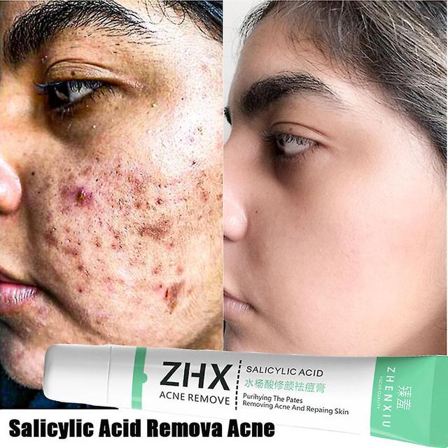 Acne Elimination Cream With Chamomile Plants, Skin Care, Treatment Of Traditional Chinese Medicine, Korean Products For The Face on Productcaster.