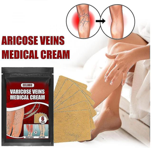 Varicose Vein Massa Paste Swollen Legs Worm Legs Vein Massa Pain Relief XLP on Productcaster.