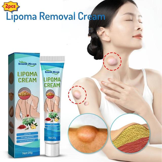 2stk Ny Lipoma fjernelse creme lipoma behandle hud hævelse delipidation creme on Productcaster.