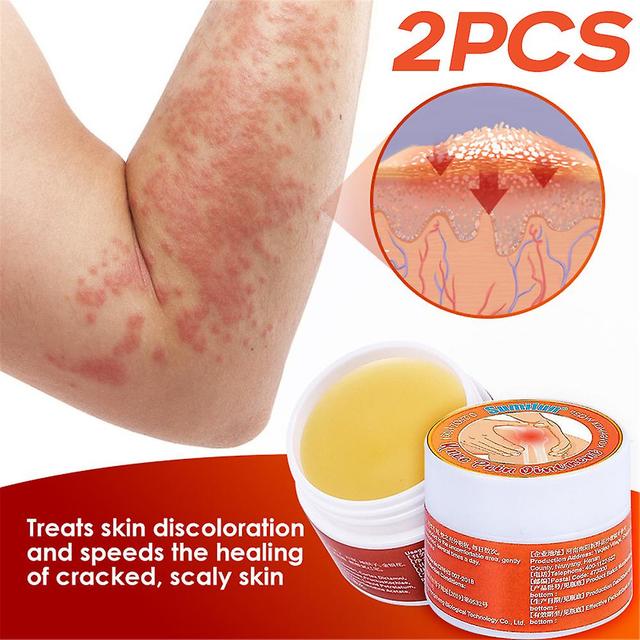 Waytogo 10g Herbal Psoriasis Cream Joint Knee Neck Shoulder Care Cream Supplies 2PCS on Productcaster.