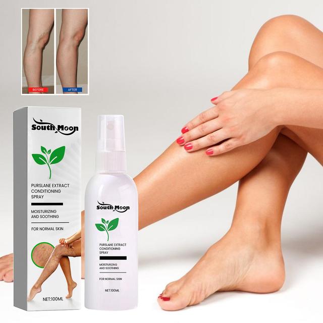 South Moon Vein Care Spray Vein Massagem Cuidados Reparos Minhoca Pernas Alivia Perna Dor Massagem Óleo1PCS) 1PCS on Productcaster.