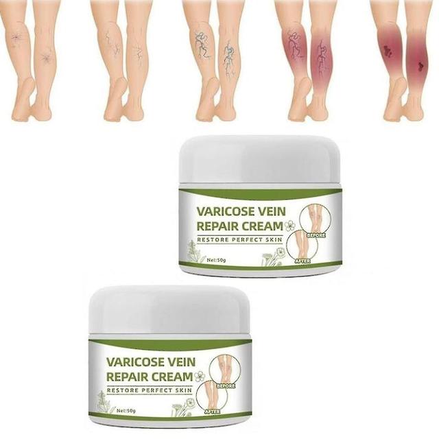 Varicose Vein Cream, Varicose Veins Repairing Cream, Treating Varicose Veins Cream For Legs, Eliminate Varicose Veins And Spider Veins On The Legs ... on Productcaster.