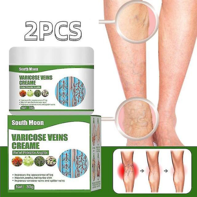 2pcs Varicose Veins Cream, Spider Leg Repair Cream Relief Phlebitis Angiitis Blood on Productcaster.