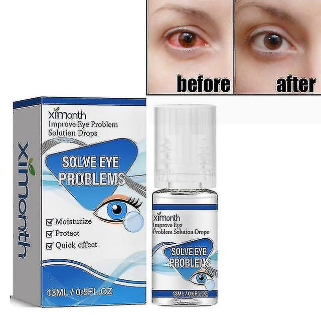 Relieves Eye Fatigue Eyedrops on Productcaster.