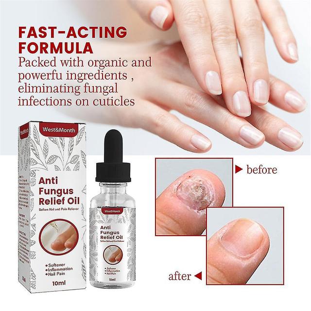 1/2pcs Anti Fungus Relief Oil Moisturizing Bright Foot Hand Nails Care Liquid 10ml on Productcaster.