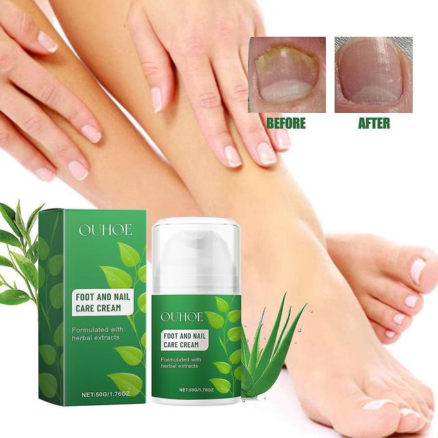 Foot And Nail Care Cream, Herbal Extracts Foot and Nail Care Ointment for Daily Use, Mizonil Cream on Productcaster.