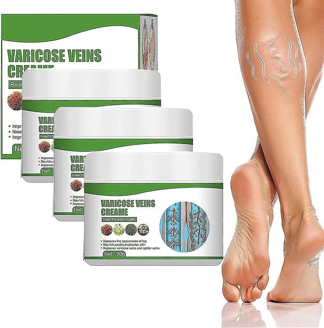 Varicose Veins Cream,varicose Vein Cream For Legs,eliminate Varicose Veins And Spider Veins,relieve Pain And Itching Of Legs KR 3 Pcs on Productcaster.