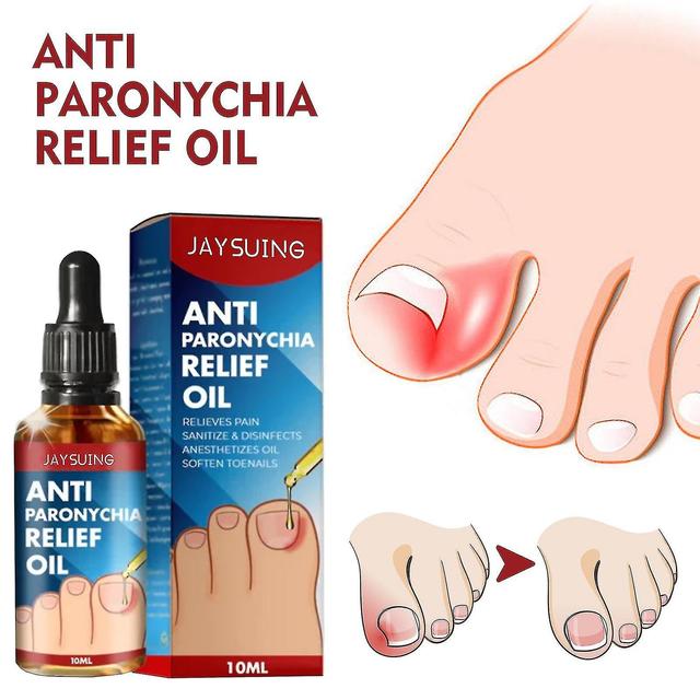 10pcs Anti-chiodo Ditch Relief Oil Onicomicosi Nail Ditch Care Oil Hk on Productcaster.