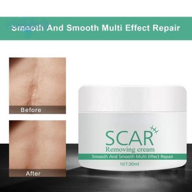 Face Natural Extract Plant Acne Stretch Scar Removing Creams For Her 50G on Productcaster.