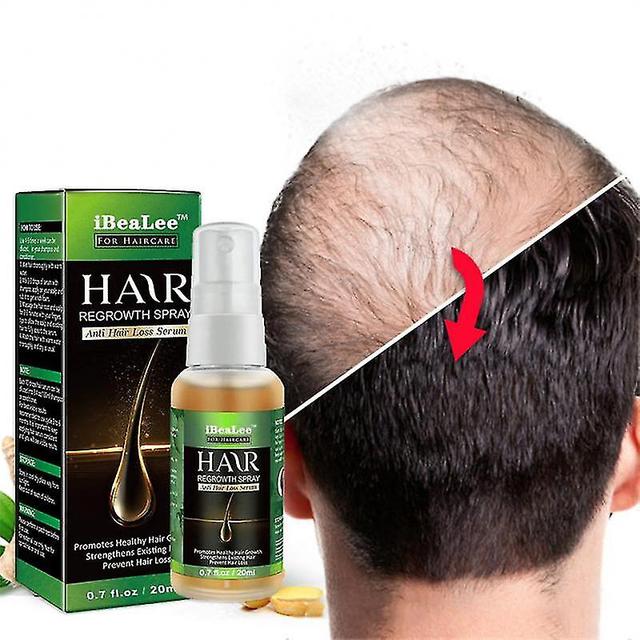 Haargroei etherische olie 20ml Ginger King Authentieke 100% haargroei vloeibare plant dicht haar on Productcaster.