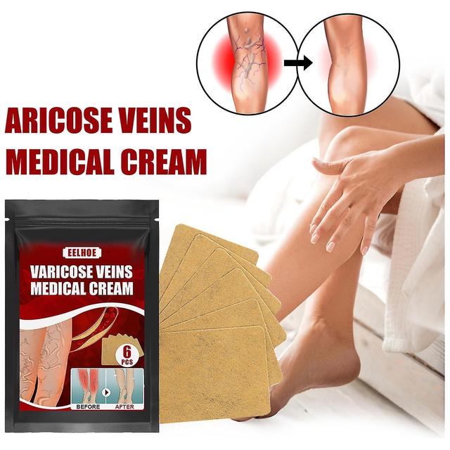 Eelhoe Varicose Vein Massage Paste Swollen Legs Earthworm Legs Vein Massage Pain Relief on Productcaster.