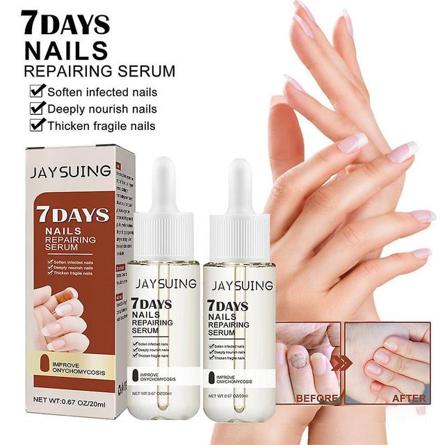 1-3pcs New 10 Days Nail Growth And Strengthening Serum, Nail Growth And Strength Serum on Productcaster.