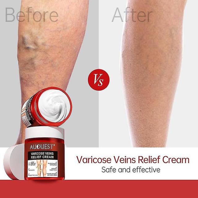 Calf Muscle Vein Care Cream Leg Blood Vessel Bulge Calf Swelling Earthworm Leg C on Productcaster.