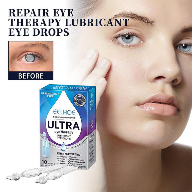 Eye Drops Natural Herbs Relieves Eyes Discomfort Blurred Vision Dry Itchy Clean Detox Care Protect Eyesight Health on Productcaster.