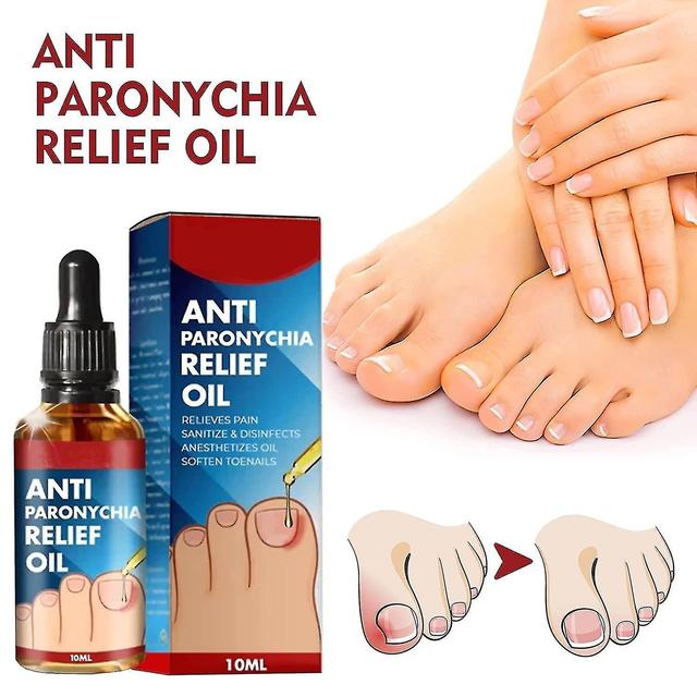 Anti Paronychia Relief Oil, Anti-paronychia Auxiliary Oil, Ingrown Toenail Correction, Nail Care Oils For Ingrown Toenails - H 3pcs on Productcaster.