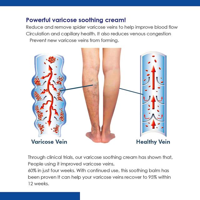 Żylny krem łagodzący redukuje pajączki, wygładza żyły i żylaki powrózka nasiennego, łagodzi obrzęki i bólC5 -GSL on Productcaster.
