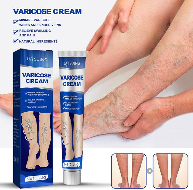 Jaysuing Vein Massage Varicose Cream Repairs Leg Vein Swellings Varicose Veins Cream Maimai Kang Cream Intravenous ointment20g box on Productcaster.