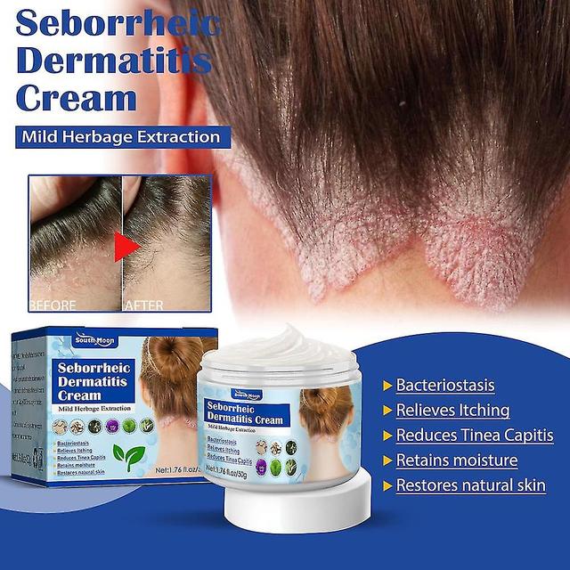 Seborrheic Skin Cream Head Acne Pruritus Scalp Ringworm Skin Problem Repai Soothing Head Skin-E on Productcaster.