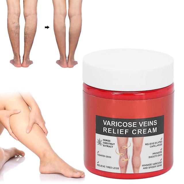 Varicose Vein Cream, Herbal Extracts Improve Blood Circulation 80g/2.82oz Leg Care Cream, Relieve Leg Phlebitis on Productcaster.