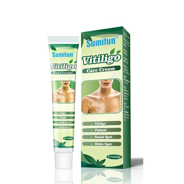 Herbal Extract Vitiligo Ointment Remove Ringworm White Spot Removal Skin Vitiligo Eliminate Vitiligo Treatment Cream on Productcaster.