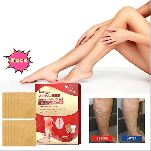 South Moon Varicose Care Herbal Patch Leg Massage Relieve Soreness Earthworm Leg Vein Care Patch Massage Oil1pcs) -GSL 6PCS on Productcaster.