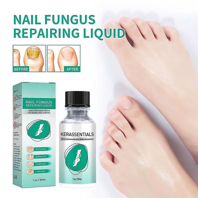 Youlaicai 2pcsx30ml Toenail Fungus Tratamento, pele saudável, unhas de cabelo para o fungo da unha do pé B on Productcaster.