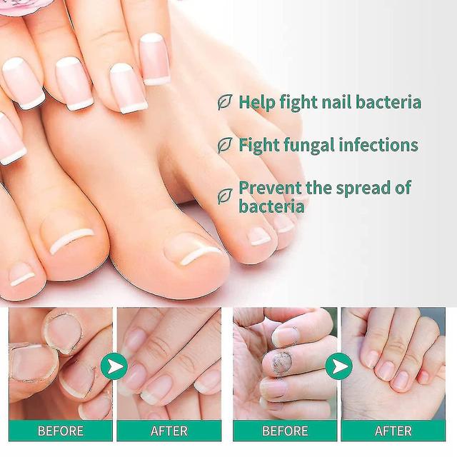 Kerassentials Toenail Fungus Treatment, Kerassentials Healthy Skin Hair Nails Kerassentials For Toenail Fungus A 2pcs on Productcaster.