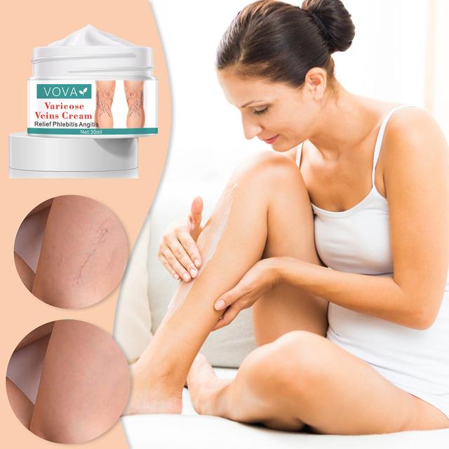 Gaoguang Varicose Veins Cream Cure Varicose Veins And Spider Veins,improve Circulation, Relieve Pain And Itching Of Legs Mardi Gras Gifts White on Productcaster.