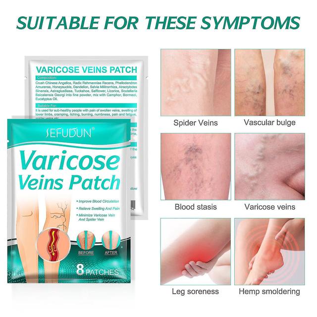 Varicose Vein Patch Varicose Vein Patch Spider Vein For Legs Spider Veins Edema Neuralgia Leg Pain Vasculitis Promote Smooth Blood Circulation on Productcaster.