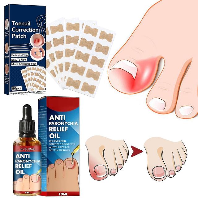 2024-50pcs Nail Correction Stickers+10ml Anti Paronychia Relief Oil, Ingrown Toenail Treatment, Nail Renewal Liquid For Damaged Discoloration Nail ... on Productcaster.