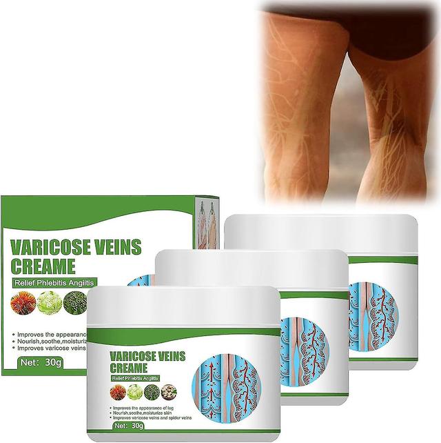 Mysept Cremevital Varicose Vein Cream, Varicose Vein Cream For Legs, Eliminate Varicose Veins And Spider Veins, Relieve Pain -ib 3pcs on Productcaster.