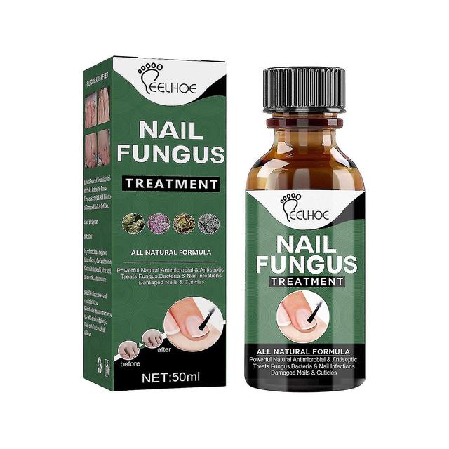 Grace 50ml Nail Fungus Treatment Solution Herbal Extracts Remove Onychomycosis No Yellowing Restore on Productcaster.