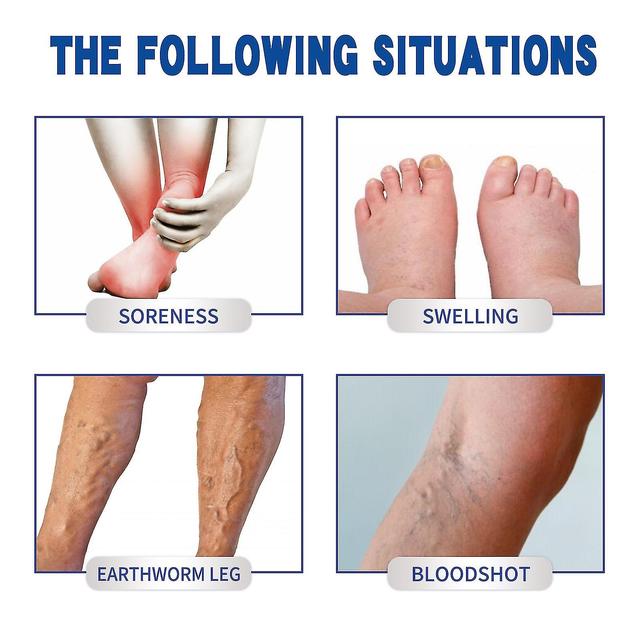 Shihaodian South Moon Venous Soothing Cream reduces spider veins, unblocks varicose veins, relieves swelling and pain c5C5 -GSL on Productcaster.