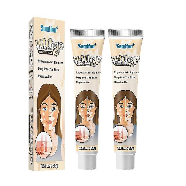 2x Bylinný extrakt Vitiligo masť Odstráňte kožný opar Odstránenie bielych škvŕn Kožný vitiligo Eliminujte krém na ošetrenie vitiliga on Productcaster.