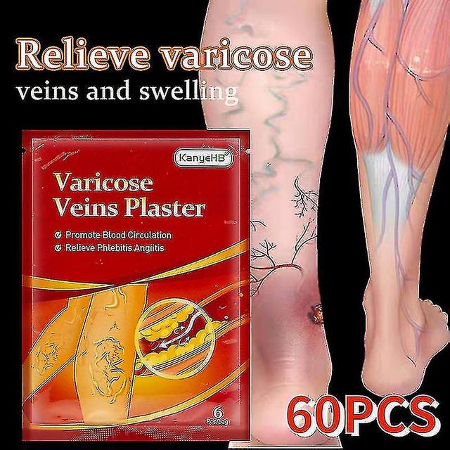 60pcs Varicose Veins Ointmnet Vasculitis Phlebitis Spider Cream Varicosity Angiitis Removal Herbal Medical Plaster Health Care 60pcs In 10bags on Productcaster.